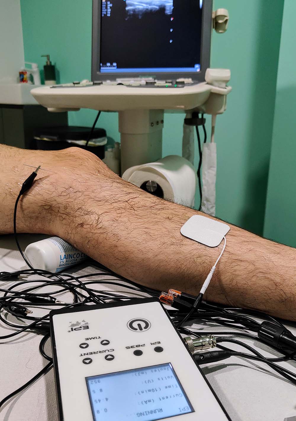 fisioterapia EPI®