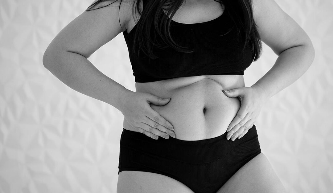 Hipopresivos y fisioterapia: claves para tratar la diástasis abdominal tras el parto